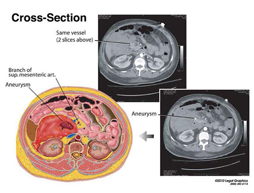 Abdominal Cross Section
